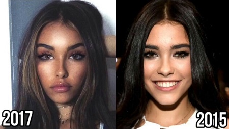 Madison Beer Plastic Surgery before and after from Reddit.