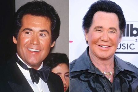 Did Wayne Newton Undergo Plastic Surgery? Find Out About It Here | Idol ...