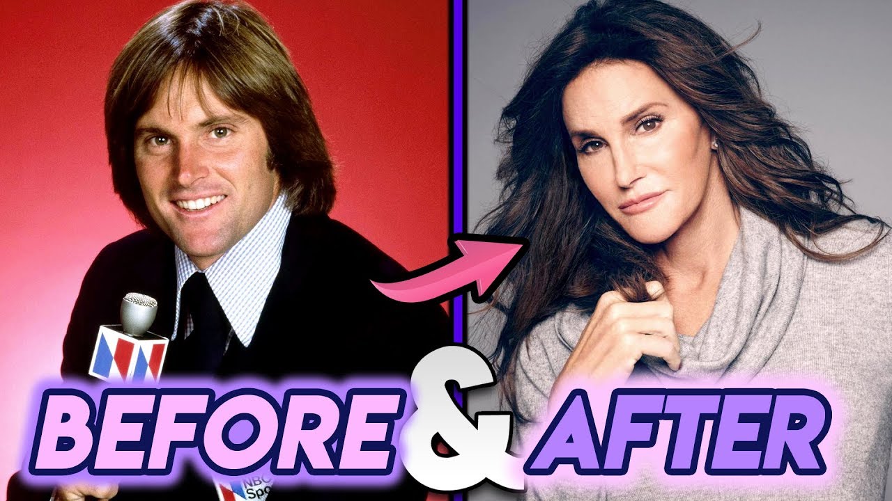 Bruce Jenner transformed to female after surgery.