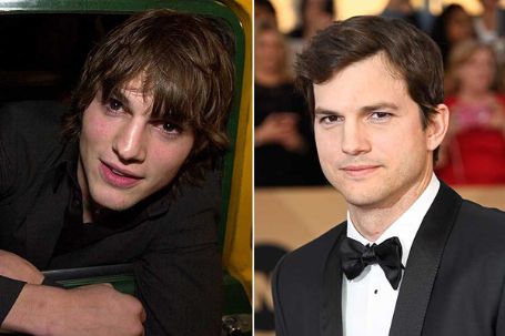 Ashton Kutcher Plastic Surgery - All Facts Here | Idol Persona