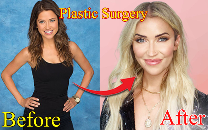 Kaitlyn Bristowe has gone through cosmetic procedures to look better.