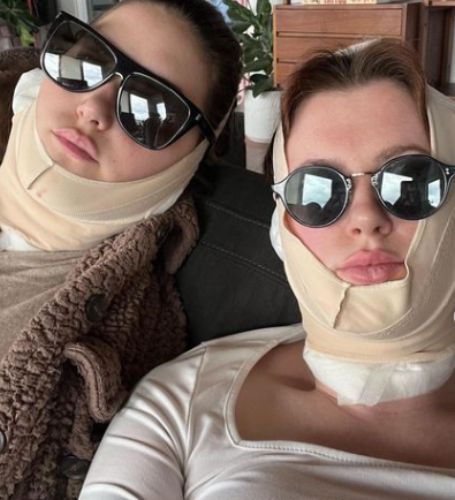 Ireland Baldwin's fans were taken aback when she announced that she had a "little facelift" at the age of 26. 