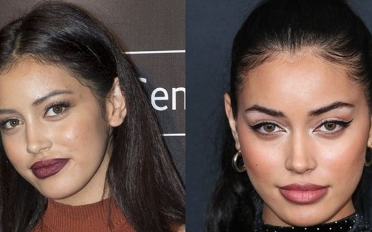 Cindy Kimberly Plastic Surgery | Get All Facts Here