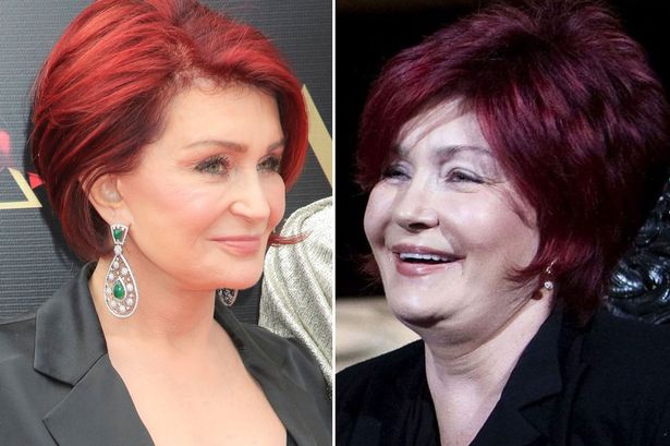 Sharon Osbourne's  Ups and Downs With Her Weight - Successful After Relapsing
